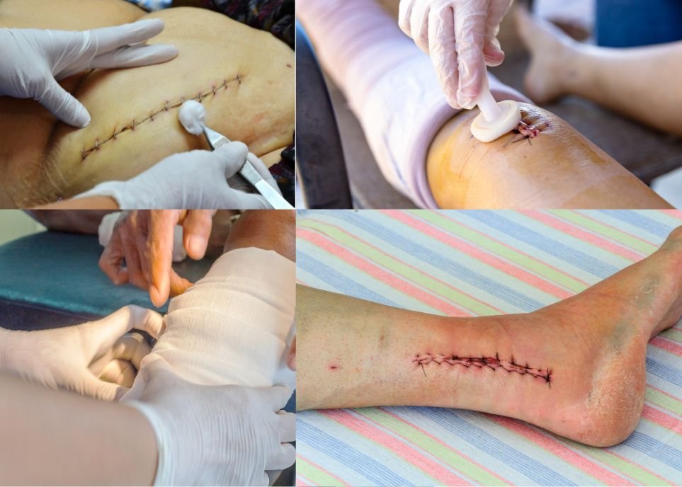 Service changement de pansement Soins infirmiers à domicile Rabat Salé Témara Maroc