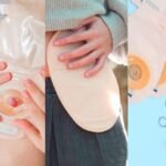 Infirmier soins de stomie à domicile Rabat Salé Témara au Maroc