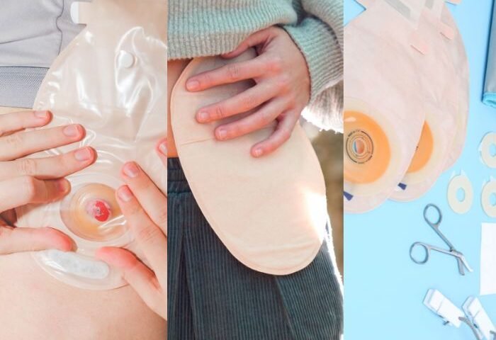 Infirmier soins de stomie à domicile Rabat Salé Témara au Maroc