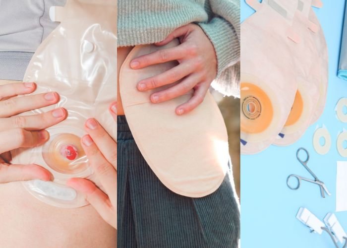 Infirmier soins de stomie à domicile Rabat Salé Témara au Maroc